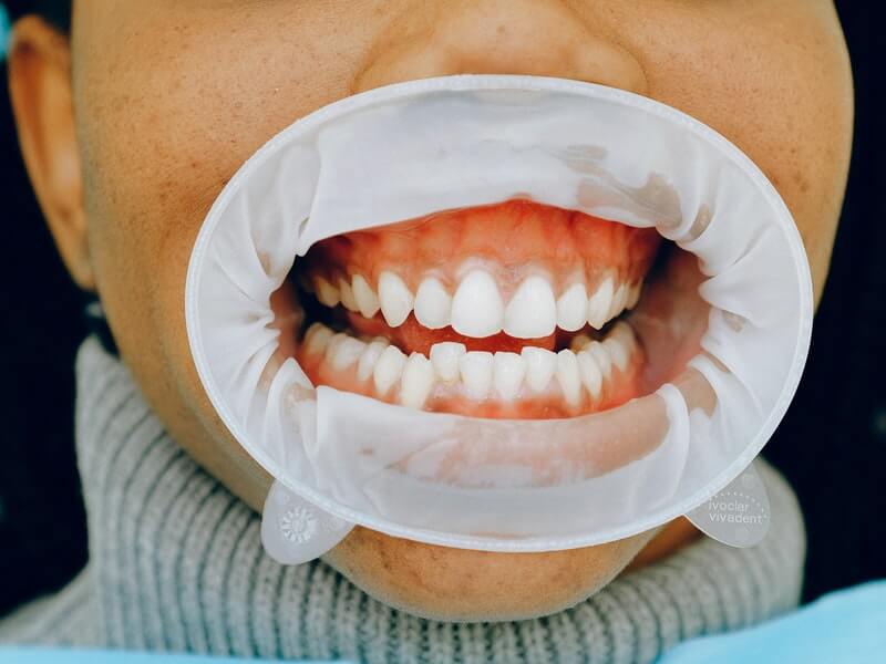 sore gums